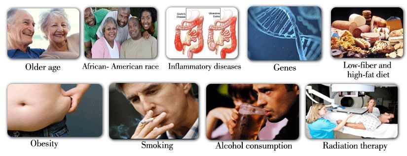 Possible causes of colorectal cancer.
