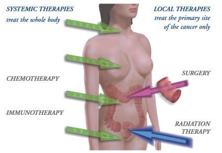 Colon Cancer Treatments.